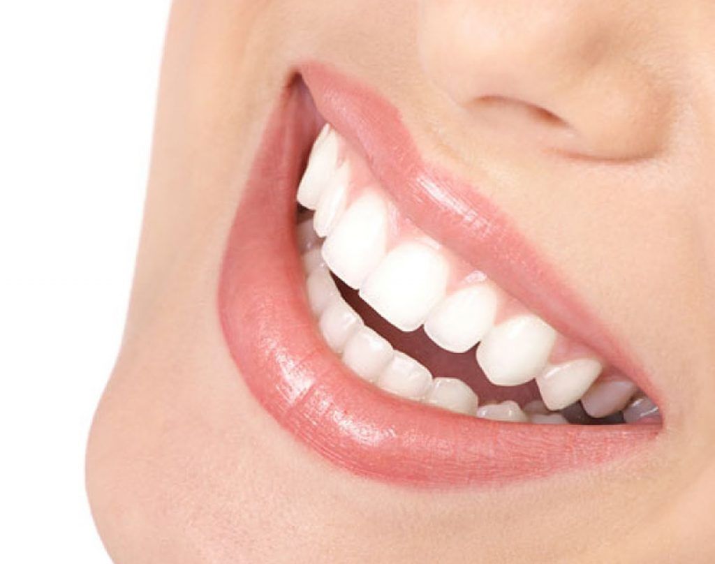 como tener una sonrisa perfecta