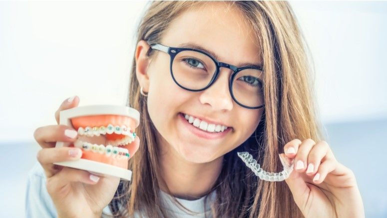 Ataches de Invisalign