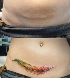 tatuaje para tapar cesárea horizontal